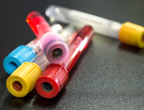 Annual Bloodwork: The Key to Catching Health Issues Before They Get Serious